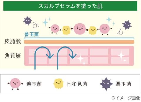 常在菌