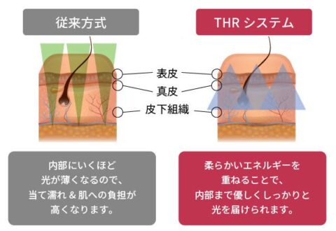 THR方式