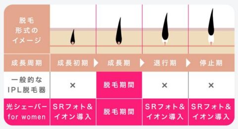 脱毛器 美顔器