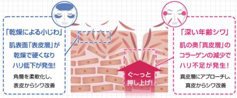 シワ改善