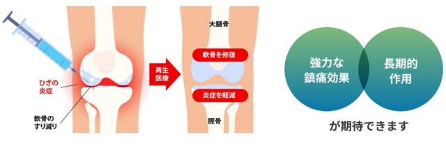 東京ひざクリニック銀座院 特徴