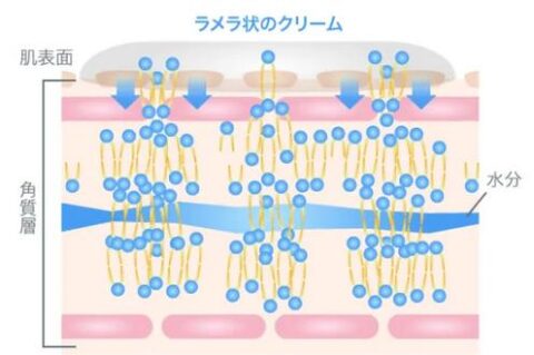 OLT オーソ・ラメラ・テクノロジー 製法