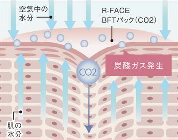 炭酸ガスパック