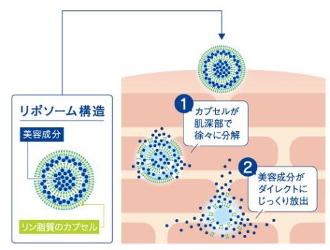 リポソーム構造