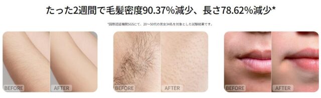 Ulike AirPro S IPL光美容器 特徴