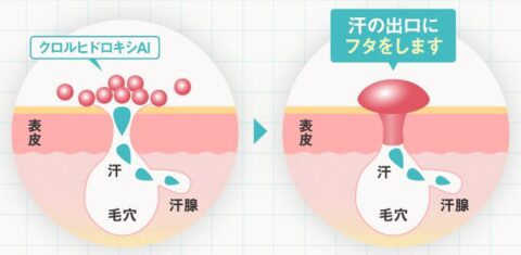 クロルヒドロキシアルミニウム