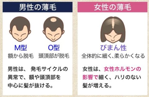 女性 薄毛 抜け毛