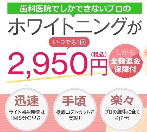 スターホワイトニング 特徴