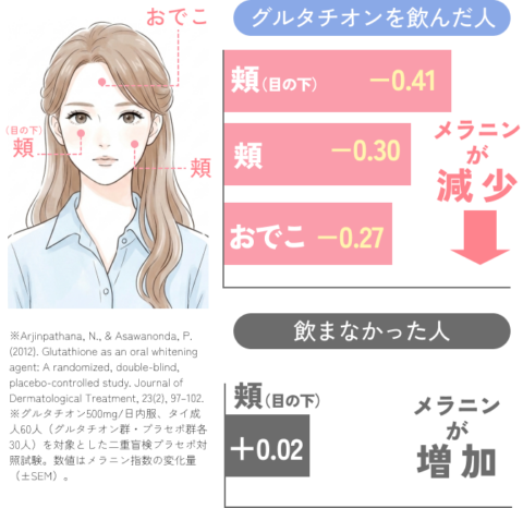 医療用グルタチオン